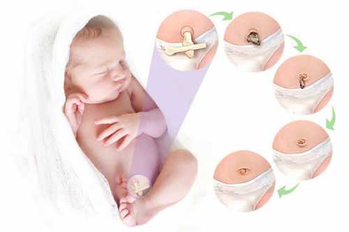 прыщики у новорождённого на лице: причины и способы избавления от них